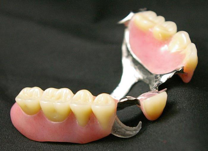 Proteza nylonu z całkowitą nieobecnością zębów i częściową. Recenzje na temat protezy nylonowe